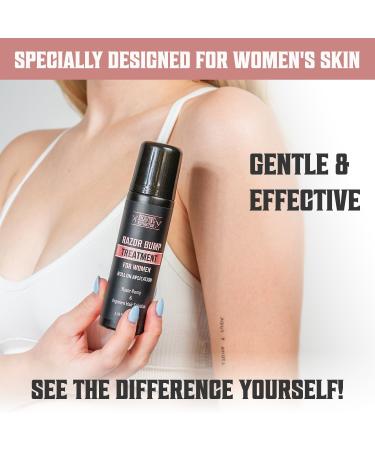 Viking Revolution Women's Razor Bumps Treatment - Ingrown Hair Serum & After Shave with Salicylic Acid - Razor Burn Relief for Bikini Area | 3.38 Fl Oz - Buy Online on GoSupps.com