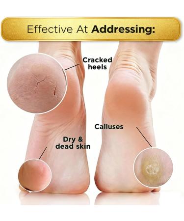  Chaies Repair Cream for Cracked Heels 60g Relief Balm Lotion - Cream for Dry and Cracked Heels and Feet - For Women and Men Travel Skin Care Pedicure - Buy Online on GoSupps.com