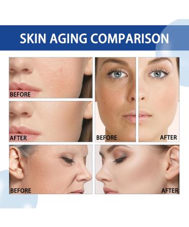 Nmbol Niacinamide Serum for Face Niacinamide Serum Anti-Aging Facial Essence Reines 5% Niacinamide Vitamin B3 & Hyaluronic Acid Pkin brightening essence for fading dark spots. - Buy Online on GoSupps.com