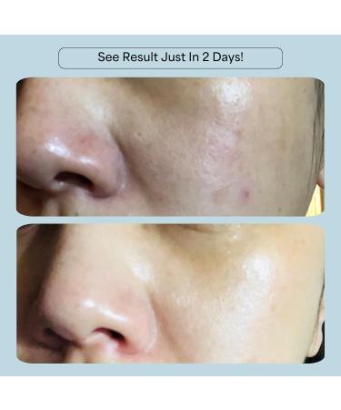 CelRevive B-Restore Barrier Cream soothes hydrates and supports microbiome balance restoring comfort to sensitive dry skin. EWG Verified for safety and transparency. Made in Australia - Buy Online on GoSupps.com