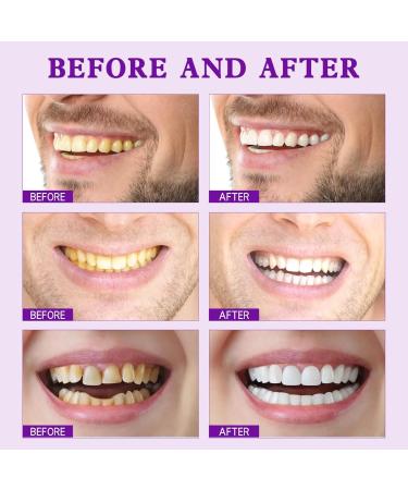 Yayashi SP-7 Probiotic Whitening Toothpaste - Lightening & Stain Removal (2PCs) | International Shipping Available - Buy Online on GoSupps.com