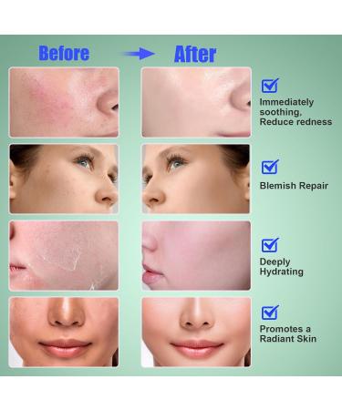 Madecassoside Toner Pads Mild Exfoliating Pads Calming Blemish Face Pad -Centella Niacinamide BHA Salicylic Acid for Soothe Uneven Skin Tone Dark Spots Skincare 125 Pad Valentines Day Fresh - Buy Online on GoSupps.com