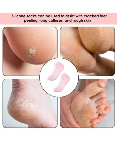 Silicone Moisture Socks for Dry Cracked Feet | Spa Gel Foot Masks - Anti-Slip Foot Care - Pink - Buy Online on GoSupps.com