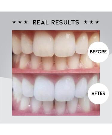 Polished London Teeth Whitening Powder | Enamel-Safe Stain Remover | Dentist Formulated Formula | Peroxide-Free & Non-Sensitive | Fresh Mint Flavor | Up to 6 Months Supply - Buy Online on GoSupps.com