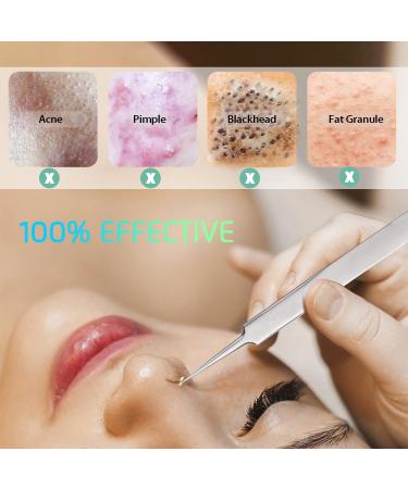 5-Piece Blackhead & Pimple Removal Tool Kit | Curved Blackhead Tweezers Set for Nose & Face Skin | Blemish & Whitehead Spot Treatment - Buy Online on GoSupps.com
