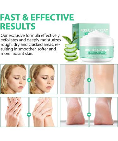 40% Urea Cream - Cracked Heel Repair Cream with 2% Salicylic Acid - Foot Cream for Cracked Heels and Dry Skin - Urea Cream 40 Percent for Feet - Callus Remover For Dry and Hard Skin Feet & Hand 100g - Buy Online on GoSupps.com