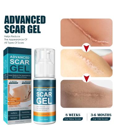 Scar Removal Cream 2pcs - Mild Gel for Old & New Scars, Stretch Marks, Wrinkles - 50ml - Buy Online on GoSupps.com