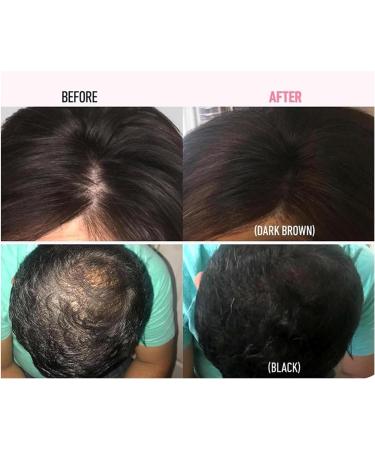 Veinsgrain Hair Color Veinsgrain Hair Powder Veinsgrain Hair Touch Up Veinsgrain Hairline Shadow Powder Veins Grain Hair Powder Enhanced Hairline Powder Veinsgrain Hairline Powder for Women (2*#11) - Buy Online on GoSupps.com