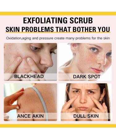 Turmeric Scrub Dark Spot Fading Turmeric Exfoliating Body Scrub Facial Peeling Brightening Exfoliating Scrubs Facial Scrub Exfoliator Natural Deep Cleansing Body Scrub Exfoliator Body Skin Care - Buy Online on GoSupps.com