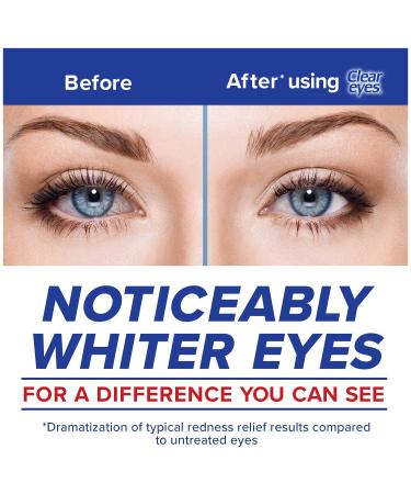 Clear Eyes Redness Relief Eye Drops - 0.5 fl oz | Soothes & Reduces Redness - Buy Online on GoSupps.com