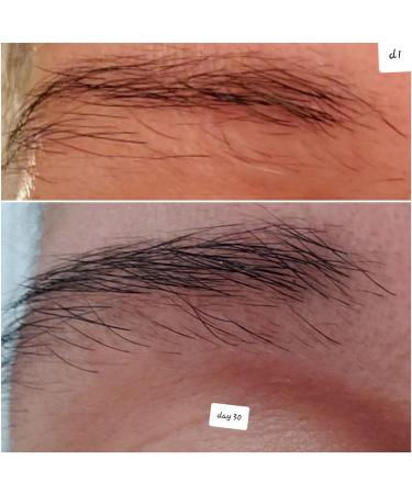 BeautyGARDE Damage Control Lash + Brow Fortifier - Enhance and Strengthen Eyelashes and Eyebrows - Buy Online on GoSupps.com