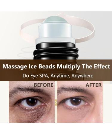 Eye Repair Stick for Men - Caffeine Under Eye Roller for EyeBags and Dark Circles Cooling Stick Hydrates and Depuffing 0.34 fl.oz. (1 PC 0.34 fl.oz. / PC) 1 PC 0.34 Fl Oz (Pack of 1) - Buy Online on GoSupps.com