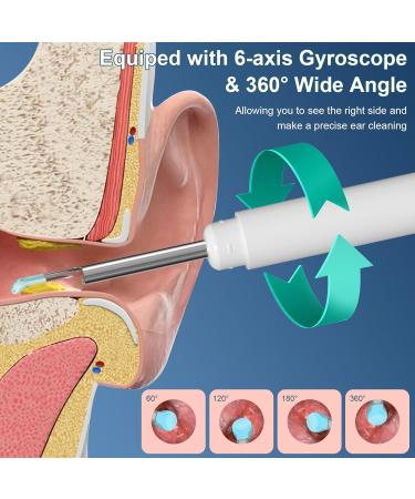 Premium Ear Wax Removal Tool with 1080P HD Camera & LED Light Complete Ear Cleaning Kit for iOS & Android - Buy Online on GoSupps.com
