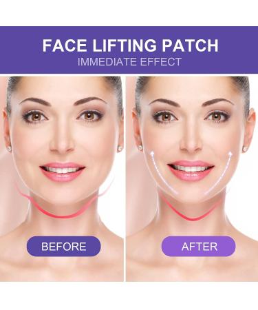 Bakovity Face Lift Tape Invisible - 40Pcs for Instant Face, Eye, and Neck Lift - Lifting Saggy Skin and Wrinkles - Pack of 1 - Buy Online on GoSupps.com