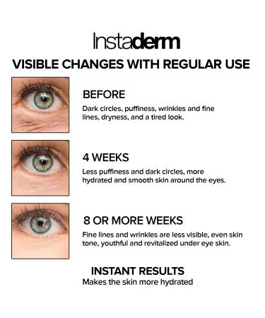 Instaderm Eye Repair Cream Reduces the Appearance of Dark Circles Puffiness Under Eye Bags Fine Lines & Wrinkle Anti-Aging Formula with Niacinamide Visibly Smooth Brighten & Hydrate Skin. - Buy Online on GoSupps.com