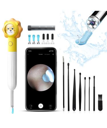 Ear Wax Removal Tool  8MP HD Ear Cleaner with Camera and 6 LED Lights  Earwax Removal Kit for Kids and Adults  Ear Camera for iPhone  iPad  Android Phones  Q3 (Yellow with Kits)