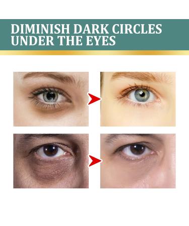 Jasmine Ointment for Dark Circles | Eye Cream with Collagen & Aloe Vera | Anti-Wrinkle Solution (1 Piece) - Buy Online on GoSupps.com