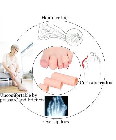 10 Pieces Silicone Toe Protection Caps - Pain Relief for Blisters Corns and Cracked Toes - Buy Online on GoSupps.com