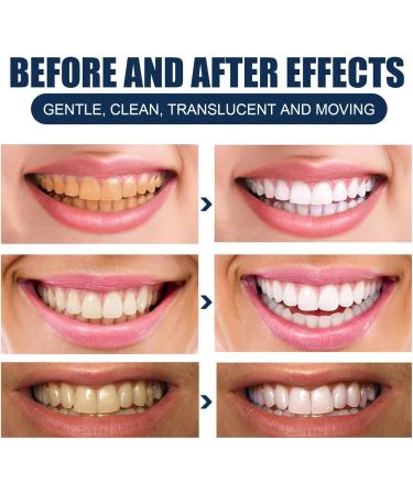 Paris Tooth Whitening - Natural Activated Charcoal Powder for White Teeth & Spot Removal (1PC) - Buy Online on GoSupps.com