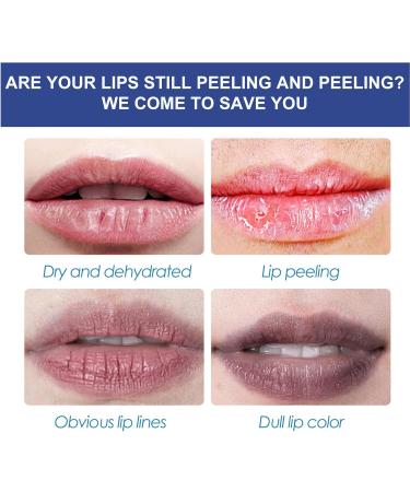 Hydrating and Moisturizing Lip Balm - Lip Care for Chapped Lips - Smooth Lip Repair Lip Balm 22g - Lip Care for Lasting Moisturizing - Spf Lip Balm for Dry Cracked Lips - Buy Online on GoSupps.com