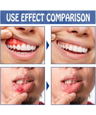 Toothache Relieving Spray Oral Care Spray Instant Teeth Treatment Relief Toothache Sprays Toothache Pain Relief Dental Pain Relief Spray Strong Pain Relief for Toothache Rapid Relief Dental Spray - Buy Online on GoSupps.com