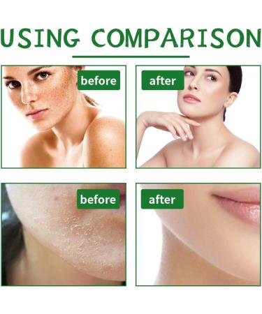  Orgrul Yeast ointment 200 ml seaweed ointment yeast ointment with the most aloe vera and ginkgo biloba care for swollen and tired legs refreshing and relaxing for all - Buy Online on GoSupps.com