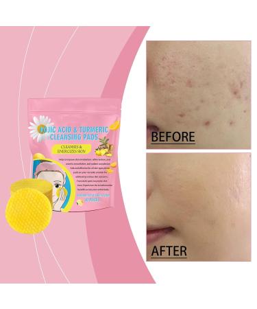 Turmeric Kojic Acid Cleansing Pads - 80 Exfoliating Face Pads for Brightening & Cleansing | International Shipping Available - Buy Online on GoSupps.com