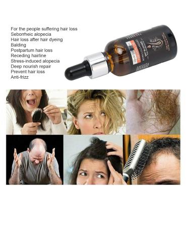Hair Growth Serum - Prevent Hair Loss & Thinning Deep Nourishing Formula for Follicle Repair 30ml | Buy Online Worldwide - Buy Online on GoSupps.com