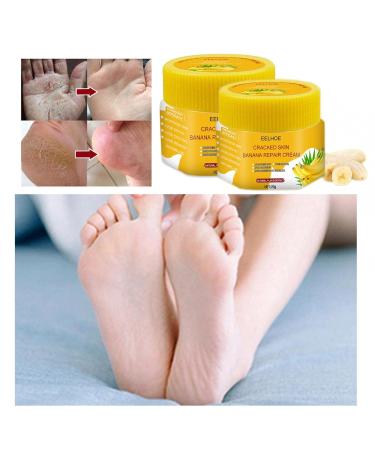 Buy 2PCs Fast-Acting Foot Balm - Restore Skin Moisture Balance - 1g Cream (Yellow) - International Shipping Available - Buy Online on GoSupps.com
