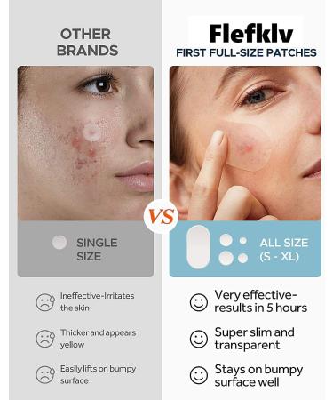 Effective Acne Pimple Patches - 7 Sizes for Large Breakouts | Tea Tree & Calendula Oil Spot Treatment | Hydrocolloid Bandages for Face Chin & Body - Buy Online on GoSupps.com