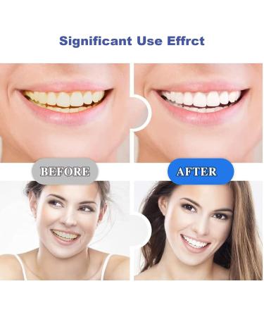 iTauyees Teeth Whitening Strips - Effective Teeth Bleaching for White Teeth & Smoke Stain Removal | 14 Strips International Shipping - Buy Online on GoSupps.com