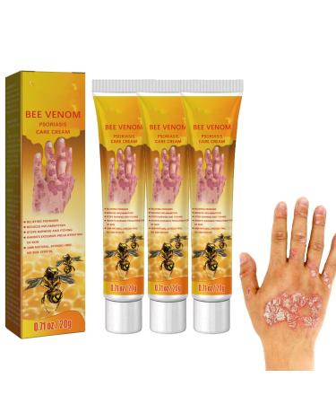 UPIKIT Bee Venom Psoriasis Treatment Cream 2/3/5PCS Psoriasis Cream for Skin for All Skin Types 20g/pc (3pcs)