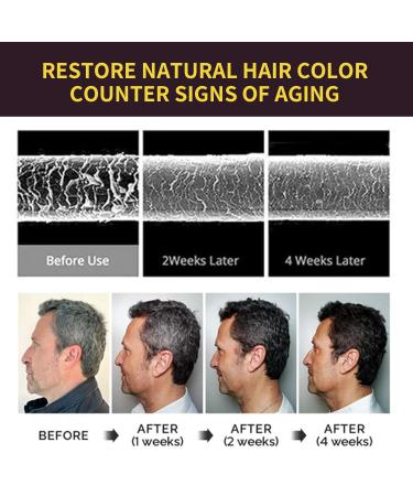 2-in-1 Blackening Shampoo for Black Hair - Quick Nourishing Hair Dye for Men & Women | Easy to Use Hair Dye Bibs - Buy Online on GoSupps.com