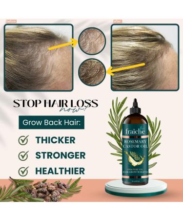 Rosemary Castor Oil for Hair Growth 16oz | Live Fraiche Natural Serum - Pure Castor Oil & Rosemary for Thicker Hair Reduce Hair Loss & Healthy Scalp - Buy Online on GoSupps.com