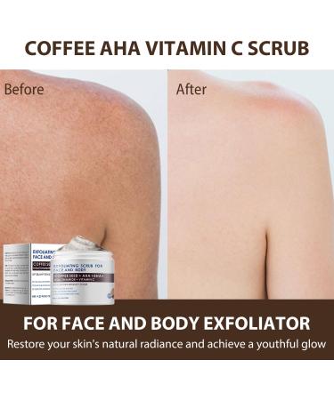 KP Bump Eraser Body Scrub Coffee Scrub with AHA BHA Exfoliating Body Scrub Ingrown Hair Treatment for Bikini Area Body Exfoliator Exfoliant for Chicken Skin Strawberry Treatment Body Scrub - Buy Online on GoSupps.com