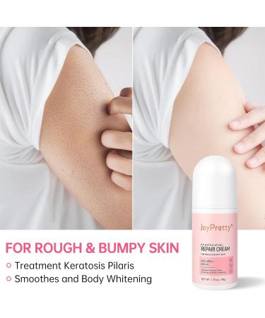 Keratosis Pilaris Lotion Legs Treatment Body Cream Skin Exfoliating Repair Cream Chicken Skin Care Cream Exfoliating Body Cream Rough Bumpy Skin Body Lotion Moisturizing Cream Gets Rid Of Redness - Buy Online on GoSupps.com