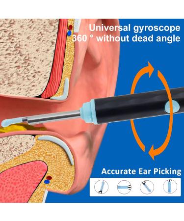 1296P HD WiFi Ear Wax Remover Kit with Camera - Waterproof Wireless Visual Ear Cleaner - Buy Online on GoSupps.com