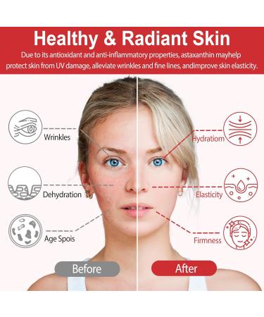 Linizanjiiy Astaxanthin 12mg 120 Softgels Premium Astaxanthin Antioxidant Supplements with Antioxidant Activity Supports Eye Skin Immune Internal Circulation - Buy Online on GoSupps.com