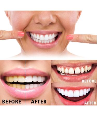New Propolis Teeth Regrow Dental Gel & Whitening Pen Set | Effective Teeth Bleaching & Stain Removal - Buy Online on GoSupps.com