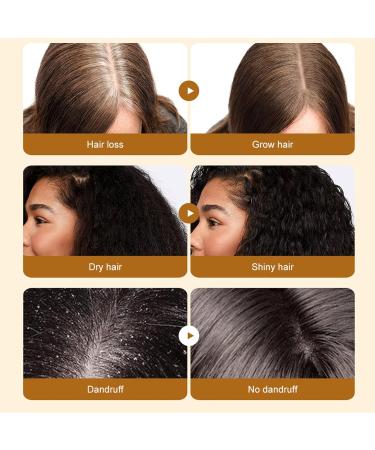 Batana Oil for Hair Growth - Batana Oil - 100% Natural - Repair Damaged Hair Nourishes Thin Hair Scalp Skin and Loss Hair Growth Fir for All Hair Types - 50ml (Batana hair oil) - Buy Online on GoSupps.com