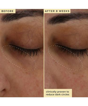 Farmacy Wake Up Honey Vitamin C Eye Cream - Brightening Under Eye Cream for Dark Circles + Puffiness - Enriched with Cranberry Peptide to Smooth Wrinkles Over Time (15ml) 0.5 Fl Oz (Pack of 1) - Buy Online on GoSupps.com