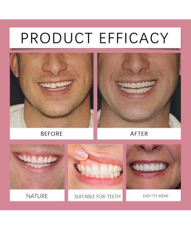 Denture Enhancement Set - Teeth Cosmetic Kit for Smile Beauty Boost Comfortable Material Fake Teeth Natural-Looking Dentures for Daily Use & Confident Grins - Buy Online on GoSupps.com