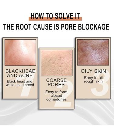  G n rique Pore Refining with Lactobionic Acid - Gentle Moisturizing Lactobionic Acid 30ml Face Oil Hydrates Replenishes Dehydrated Skin Fast Moisture Absorption for Thirsty Skin - Buy Online on GoSupps.com