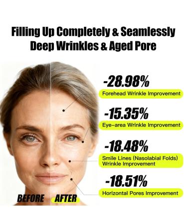 Retinal Shot Tightening Booster+ Retinol Tightening Serum - Buy Online on GoSupps.com