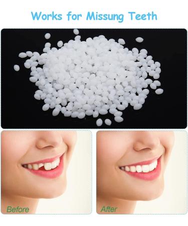 Brigtviee Instant Veneer Temporary Prostheses - 2 Pairs of Upper & Lower Cosmetic Fake Teeth for a Perfect Smile - Buy Online on GoSupps.com