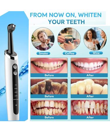 Electric Tooth Polisher & Whitening Kit | USB Rechargeable, Waterproof, Multifunctional Teeth Cleaning Tool - White - Buy Online on GoSupps.com