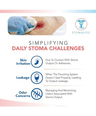 Buy 2 Skin Barrier Rings (10 Rings) - Easy-to-Clean Leak-Preventing Stoma Accessories | Best Ostomy-Colostomy-Ileostomy Solutions - Buy Online on GoSupps.com