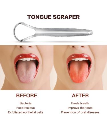 AILE Tongue Scraper | Stainless Steel Tongue Cleaner for Adults & Kids | Reduce Bad Breath & Enhance Oral Hygiene - Buy Online on GoSupps.com