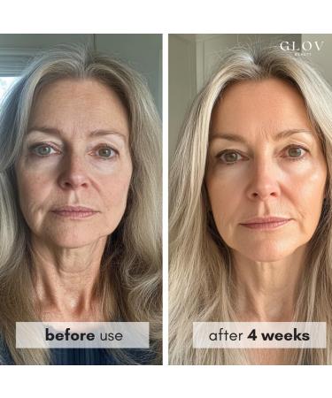 Glov Beauty Face Moisturizer with Squalane & Niacinamide - Anti Aging Hydrating Face Cream for All Skin Types, Daily Moisturizer Face Cream for Women - Buy Online on GoSupps.com