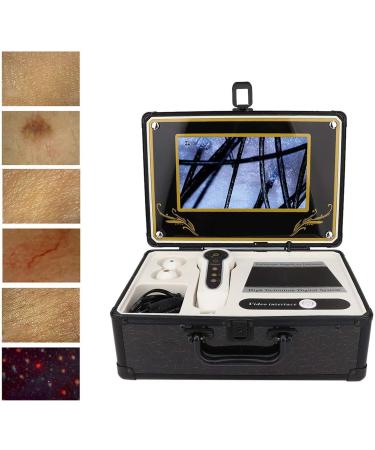 9 Inch LCD Skin Hair Follicle Detector 50X/200X Hair Analyzer 15 Inch Scalp Hair Follicle Detector HD LCD Screen Four Colors Skin Pigment Detector Analyzer - Buy Online on GoSupps.com